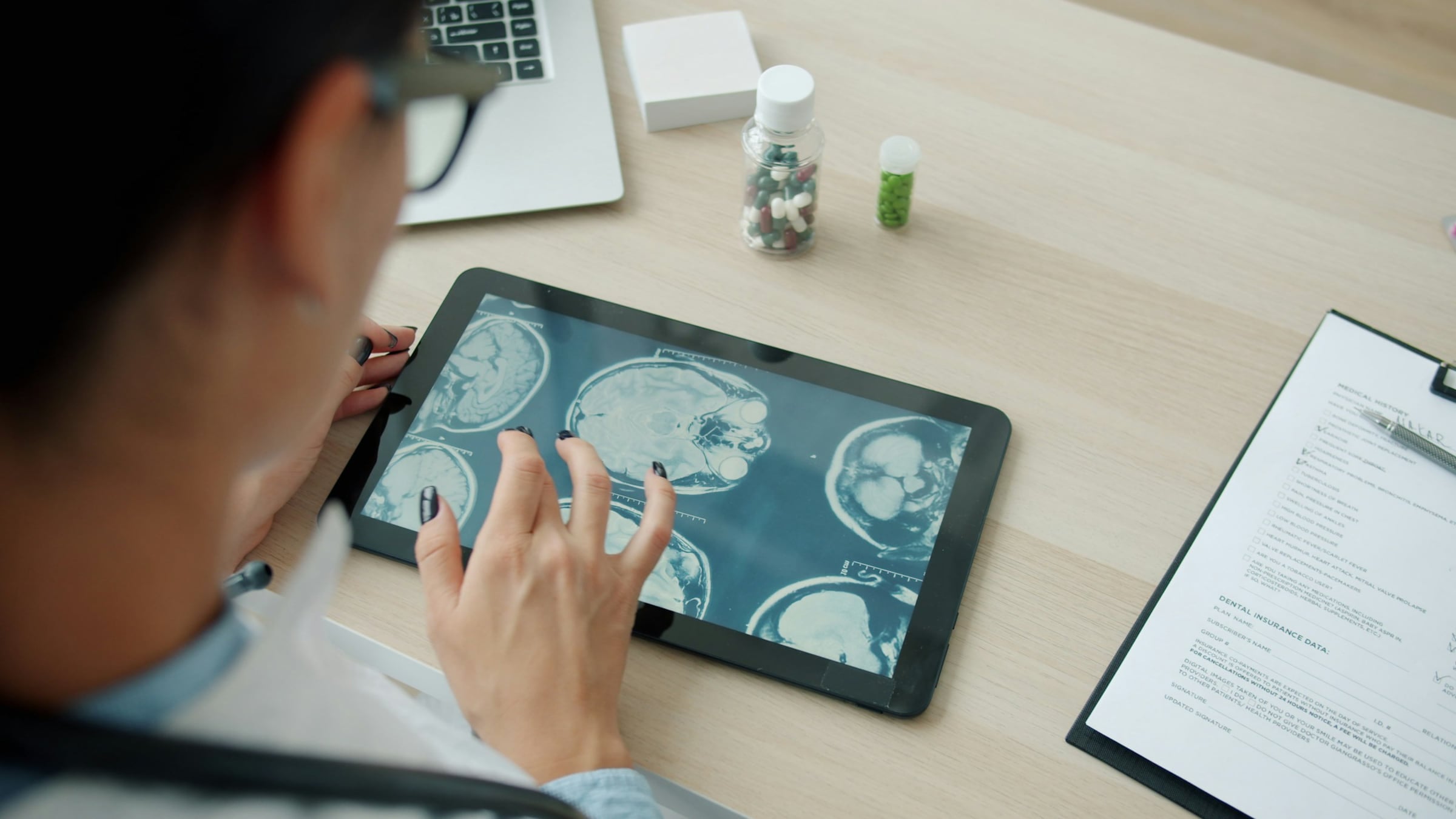 Doctor reviewing MRI scans on a tablet in a clinic